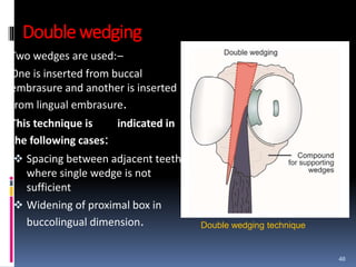 Double wedging
Two wedges are used:–
One is inserted from buccal
embrasure and another is inserted
from lingual embrasure.
This technique is indicated in
the following cases:
 Spacing between adjacent teeth
where single wedge is not
sufficient
 Widening of proximal box in
buccolingual dimension.
46
Double wedging technique
 