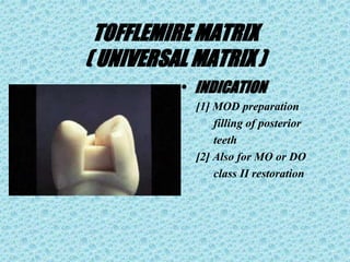 TOFFLEMIRE MATRIX
( UNIVERSAL MATRIX )
• INDICATION
[1] MOD preparation
filling of posterior
teeth
[2] Also for MO or DO
class II restoration
 