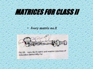 MATRICES FOR CLASS II
• Ivory matrix no.8
 