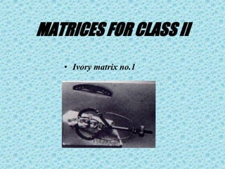 MATRICES FOR CLASS II
• Ivory matrix no.1
 