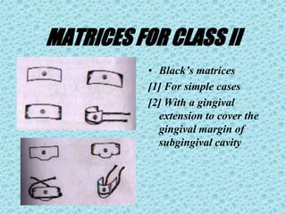 MATRICES FOR CLASS II
• Black’s matrices
[1] For simple cases
[2] With a gingival
extension to cover the
gingival margin of
subgingival cavity
 