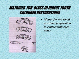 MATRICES FOR CLASS III DIRECT TOOTH
COLOURED RESTORATIONS
• Matrix for two small
proximal preparation
in contact with each
other
 