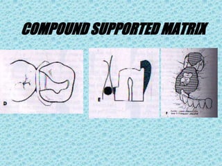 COMPOUND SUPPORTED MATRIX
 