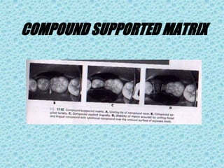 COMPOUND SUPPORTED MATRIX
 