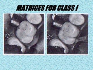 MATRICES FOR CLASS I
 