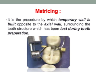 Matricing :
• It is the procedure by which temporary wall is
built opposite to the axial wall, surrounding the
tooth structure which has been lost during tooth
preparation.
 
