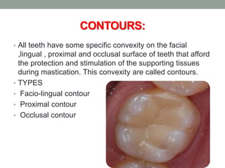 CONTOURS:
• All teeth have some specific convexity on the facial
,lingual , proximal and occlusal surface of teeth that afford
the protection and stimulation of the supporting tissues
during mastication. This convexity are called contours.
• TYPES
• Facio-lingual contour
• Proximal contour
• Occlusal contour
 