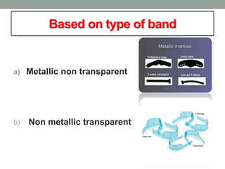Based on type of band
a) Metallic non transparent
b) Non metallic transparent
 