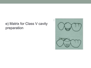 e) Matrix for Class V cavity
preparation
 