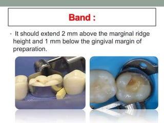 Band :
• It should extend 2 mm above the marginal ridge
height and 1 mm below the gingival margin of
preparation.
 
