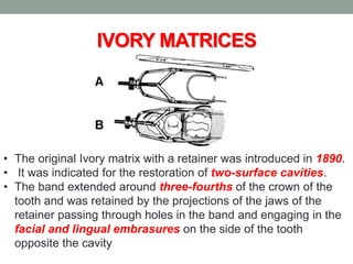 IVORY MATRICES
• The original Ivory matrix with a retainer was introduced in 1890.
• It was indicated for the restoration of two-surface cavities.
• The band extended around three-fourths of the crown of the
tooth and was retained by the projections of the jaws of the
retainer passing through holes in the band and engaging in the
facial and lingual embrasures on the side of the tooth
opposite the cavity
 