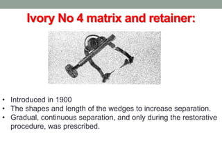 Ivory No 4 matrix and retainer:
• Introduced in 1900
• The shapes and length of the wedges to increase separation.
• Gradual, continuous separation, and only during the restorative
procedure, was prescribed.
 