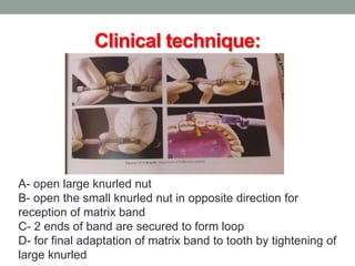 Clinical technique:
A- open large knurled nut
B- open the small knurled nut in opposite direction for
reception of matrix band
C- 2 ends of band are secured to form loop
D- for final adaptation of matrix band to tooth by tightening of
large knurled
 