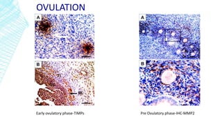 OVULATION
Pre Ovulatory phase-IHC-MMP2Early ovulatory phase-TIMPs
 