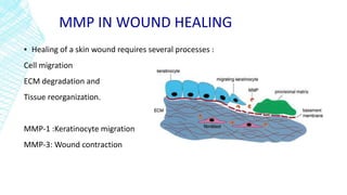 MMP IN WOUND HEALING
▪ Healing of a skin wound requires several processes :
Cell migration
ECM degradation and
Tissue reorganization.
MMP-1 :Keratinocyte migration
MMP-3: Wound contraction
 