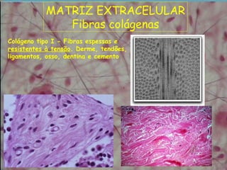 MATRIZ EXTRACELULAR
Fibras colágenas
Colágeno tipo I - Fibras espessas e
resistentes à tensão. Derme, tendões,
ligamentos, osso, dentina e cemento
 