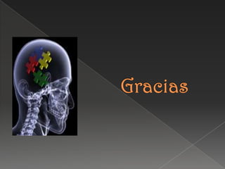 Matriz Interna – Externa