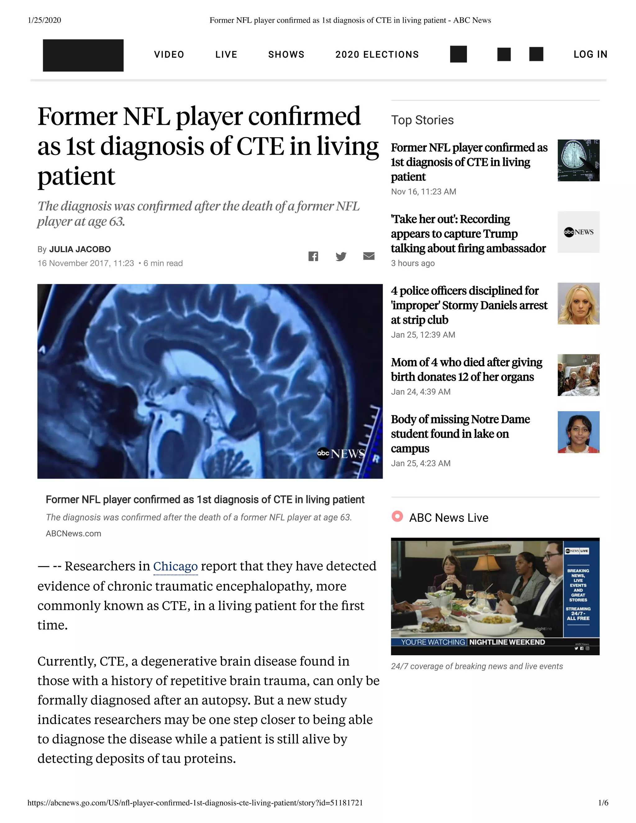 Former NFL player confirmed as 1st diagnosis of CTE in living patient | PDF