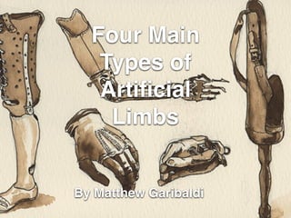 Four Main
Types of
Artiﬁcial
Limbs
By Matthew Garibaldi
 