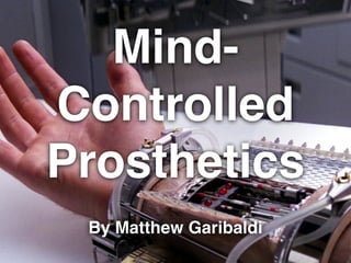 Mind-
Controlled
Prosthetics
By Matthew Garibaldi
 