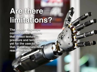 Are there
limitations?
The robotic ﬁngertips
contain tactile sensors
that detect texture,
pressure and temperature,
yet for the user to feel
that, these signals need to
reach the brain
 