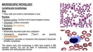 MICROSCOPIC PATHOLOGY
Lymphocyte morphology
Size
• Hairy cells are small to intermediate in size.
Nucleus
• Nuclear contour: Central oval to bean-shaped nucleus
• Chromatin: uniform chromatin
• Nucleolus: No nucleolus.
Cytoplasm
• Moderately abundant pale blue cytoplasm.
• Cytoplasmic projections ("hairs") are typically
circumferential.
• Cytoplasmic vacuoles or inclusions that represent ribosomal-
lamellar complexes.
The classic hairy cell morphology is often less evident in BM
aspirate smears, but can be seen in extensively involved
samples with well-prepared smears
 