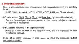 2. Immunohistochemistry
• Panel of immunohistochemical stains provides high diagnostic sensitivity and specificity
for HCL:
oCD25, CD11c, Annexin-A1, CD123, CD200, CD103, BRAF, and DBA.44 all useful.
• HCL cells express CD25, CD123, CD11c, and Annexin A1 by immunohistochemistry.
oSome of these antigens also are expressed in other marrow cells (such as Annexin
A1 positivity in neutrophils).
• DBA.44 stains hairy cells in BM trephine sections
oHowever, it may not stain all the neoplastic cells, and it is expressed in other
lymphomas, as SMZL.
• Cyclin D1 is weakly expressed in most cases but lacks any associated CCND1
rearrangement in HCL.
 
