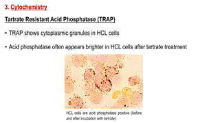 3. Cytochemistry
Tartrate Resistant Acid Phosphatase (TRAP)
• TRAP shows cytoplasmic granules in HCL cells
• Acid phosphatase often appears brighter in HCL cells after tartrate treatment
HCL cells are acid phosphatase positive (before
and after incubation with tartrate).
 