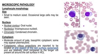 MICROSCOPIC PATHOLOGY
Lymphocyte morphology
Size
• Small to medium sized. Occasional large cells may be
seen.
Nucleus
• Nuclear contour: Oval nuclei.
• Nucleolus: Inconspicuous nucleoli.
• Chromatin: Condensed chromatin.
Cytoplasm
• Moderate amount of pale, basophilic cytoplasm; some
may appear plasmacytoid.
• Cytoplasmic villous projections are reported to be
located at one aspect of the cell surface (polarized)
and are relatively short compared to the longer villi
present all around the cell surface in HCL
 