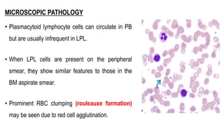 MICROSCOPIC PATHOLOGY
• Plasmacytoid lymphocyte cells can circulate in PB
but are usually infrequent in LPL.
• When LPL cells are present on the peripheral
smear, they show similar features to those in the
BM aspirate smear.
• Prominent RBC clumping (rouleauxe formation)
may be seen due to red cell agglutination.
 
