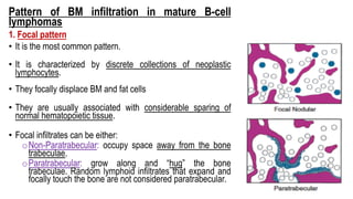 Pattern of BM infiltration in mature B-cell
lymphomas
1. Focal pattern
• It is the most common pattern.
• It is characterized by discrete collections of neoplastic
lymphocytes.
• They focally displace BM and fat cells
• They are usually associated with considerable sparing of
normal hematopoietic tissue.
• Focal infiltrates can be either:
oNon-Paratrabecular: occupy space away from the bone
trabeculae.
oParatrabecular: grow along and “hug” the bone
trabeculae. Random lymphoid infiltrates that expand and
focally touch the bone are not considered paratrabecular.
 