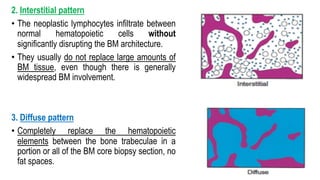 2. Interstitial pattern
• The neoplastic lymphocytes infiltrate between
normal hematopoietic cells without
significantly disrupting the BM architecture.
• They usually do not replace large amounts of
BM tissue, even though there is generally
widespread BM involvement.
3. Diffuse pattern
• Completely replace the hematopoietic
elements between the bone trabeculae in a
portion or all of the BM core biopsy section, no
fat spaces.
 