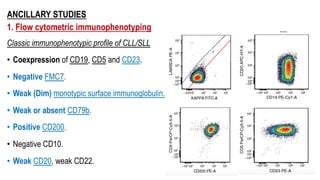 ANCILLARY STUDIES
1. Flow cytometric immunophenotyping
Classic immunophenotypic profile of CLL/SLL
• Coexpression of CD19, CD5 and CD23.
• Negative FMC7.
• Weak (Dim) monotypic surface immunoglobulin..
• Weak or absent CD79b.
• Positive CD200.
• Negative CD10.
• Weak CD20, weak CD22.
 