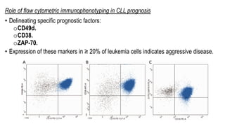 Role of flow cytometric immunophenotyping in CLL prognosis
• Delineating specific prognostic factors:
oCD49d.
oCD38.
oZAP-70.
• Expression of these markers in ≥ 20% of leukemia cells indicates aggressive disease.
 