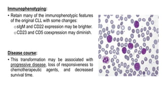 Immunophenotyping:
• Retain many of the immunophenotypic features
of the original CLL with some changes:
osIgM and CD22 expression may be brighter.
oCD23 and CD5 coexpression may diminish.
Disease course:
• This transformation may be associated with
progressive disease, loss of responsiveness to
chemotherapeutic agents, and decreased
survival time.
 