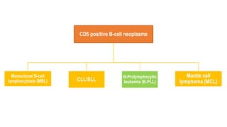 CD5 positive B-cell neoplasms
Monoclonal B-cell
lymphocytosis (MBL) CLL/SLL
B-Prolymphocytic
leukemia (B-PLL)
Mantle cell
lymphoma (MCL)
 