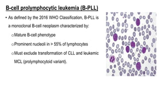 B-cell prolymphocytic leukemia (B-PLL)
• As defined by the 2016 WHO Classification, B-PLL is
a monoclonal B-cell neoplasm characterized by:
oMature B-cell phenotype
oProminent nucleoli in > 55% of lymphocytes
oMust exclude transformation of CLL and leukemic
MCL (prolymphocytoid variant).
 