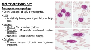 MICROSCOPIC PATHOLOGY
Prolymphocyte morphology
• Count: Must exceed 55% of lymphocytes.
• Size
oA relatively homogeneous population of large
cells.
• Nucleus
oContour: Round nuclear contours
oChromatin: Moderately condensed nuclear
chromatin
oNucleolus: Central prominent nucleoli.
• Cytoplasm
oModerate amounts of pale blue, agranular
cytoplasm.
 