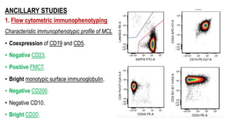 ANCILLARY STUDIES
1. Flow cytometric immunophenotyping
Characteristic immunophenotypic profile of MCL
• Coexpression of CD19 and CD5.
• Negative CD23.
• Positive FMC7.
• Bright monotypic surface immunoglobulin.
• Negative CD200.
• Negative CD10.
• Bright CD20.
 