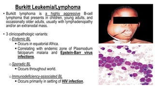 Burkitt Leukemia/Lymphoma
• Burkitt lymphoma is a highly aggressive B-cell
lymphoma that presents in children, young adults, and
occasionally older adults, usually with lymphadenopathy
and/or an extranodal mass.
• 3 clinicopathologic variants:
oEndemic BL
§ Occurs in equatorial Africa.
§ Correlating with endemic zone of Plasmodium
falciparum malaria and Epstein-Barr virus
infections.
oSporadic BL
§ Occurs throughout world.
oImmunodeficiency-associated BL
§ Occurs primarily in setting of HIV infection.
 