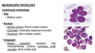 MICROSCOPIC PATHOLOGY
Lymphocyte morphology:
• Size
oMedium sized
• Nucleus
oNuclear contour: Round nuclear contour.
oChromatin: moderately dispersed chromatin.
oNucleolus: often multiple nucleoli.
• Cytoplasm
oDeeply basophilic cytoplasm that
characteristically contains numerous small
vacuoles, which contain lipid
 