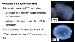 Fluorescence in Situ Hybridization (FISH)
• FISH is useful for detecting MYC translocations.
oBreak-apart probe commonly used to demonstrate
MYC translocations.
oDual-color, dual-fusion probe for MYC-IGH
translocation.
• 90% of cases detect MYC rearrangement by FISH.
• 10% of cases do not show MYC rearrangement by
FISH.
C-MYC
MYC-IGH
 