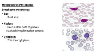 MICROSCOPIC PATHOLOGY
Lymphocyte morphology:
• Size
oSmall sized
• Nucleus
oDeep nuclear clefts or grooves.
oMarkedly irregular nuclear contours.
• Cytoplasm
oThin rim of cytoplasm.
 