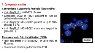 2. Cytogenetic studies
Conventional Cytogenetic Analysis (Karyotyping)
• t(14;18)(q32;q21) in 80-90% of cases.
• Juxtaposes BCL2 at 18q21 adjacent to IGH on
derivative chromosome 14.
• t(14;18)(q32;q21)(IGH-BCL2) present in up to 90%
of grade 1-2 FL.
• t(14;18)(q32;q21)(IGH-BCL2) much less frequent in
grade 3B FL.
Fluorescence in Situ Hybridization (FISH)
• FISH can detect t(14;18)(q32;q21) in up to 90% of
FL cases.
• Quicker and easier to performed than PCR.
IGH-BCL2
 