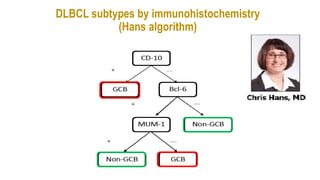 DLBCL subtypes by immunohistochemistry
(Hans algorithm)
 