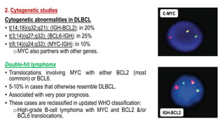 2. Cytogenetic studies
Cytogenetic abnormalities in DLBCL
• t(14;18)(q32;q21); (IGH-BCL2): in 20%
• t(3;14)(q27;q32); (BCL6-IGH): in 25%
• t(8;14)(q24;q32); (MYC-IGH): in 10%
oMYC also partners with other genes.
Double-hit lymphoma
• Translocations involving MYC with either BCL2 (most
common) or BCL6.
• 5-10% in cases that otherwise resemble DLBCL.
• Associated with very poor prognosis.
• These cases are reclassified in updated WHO classification:
oHigh-grade B-cell lymphoma with MYC and BCL2 &/or
BCL6 translocations.
BCL2-IGH
C-MYC
IGH-BCL2
 