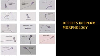 MATURE SPERM MORPHOLOGY AND SEMINAL PLASMA [Autosaved].pptx