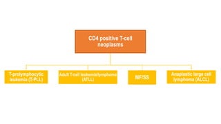 CD4 positive T-cell
neoplasms
T-prolymphocytic
leukemia (T-PLL)
Adult T-cell leukemia/lymphoma
(ATLL) MF/SS
Anaplastic large cell
lymphoma (ALCL)
 