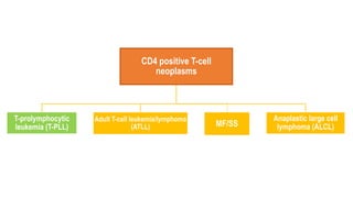 CD4 positive T-cell
neoplasms
T-prolymphocytic
leukemia (T-PLL)
Adult T-cell leukemia/lymphoma
(ATLL) MF/SS
Anaplastic large cell
lymphoma (ALCL)
 