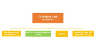 CD4 positive T-cell
neoplasms
T-prolymphocytic
leukemia (T-PLL)
Adult T-cell leukemia/lymphoma
(ATLL) MF/SS
Anaplastic large cell
lymphoma (ALCL)
 